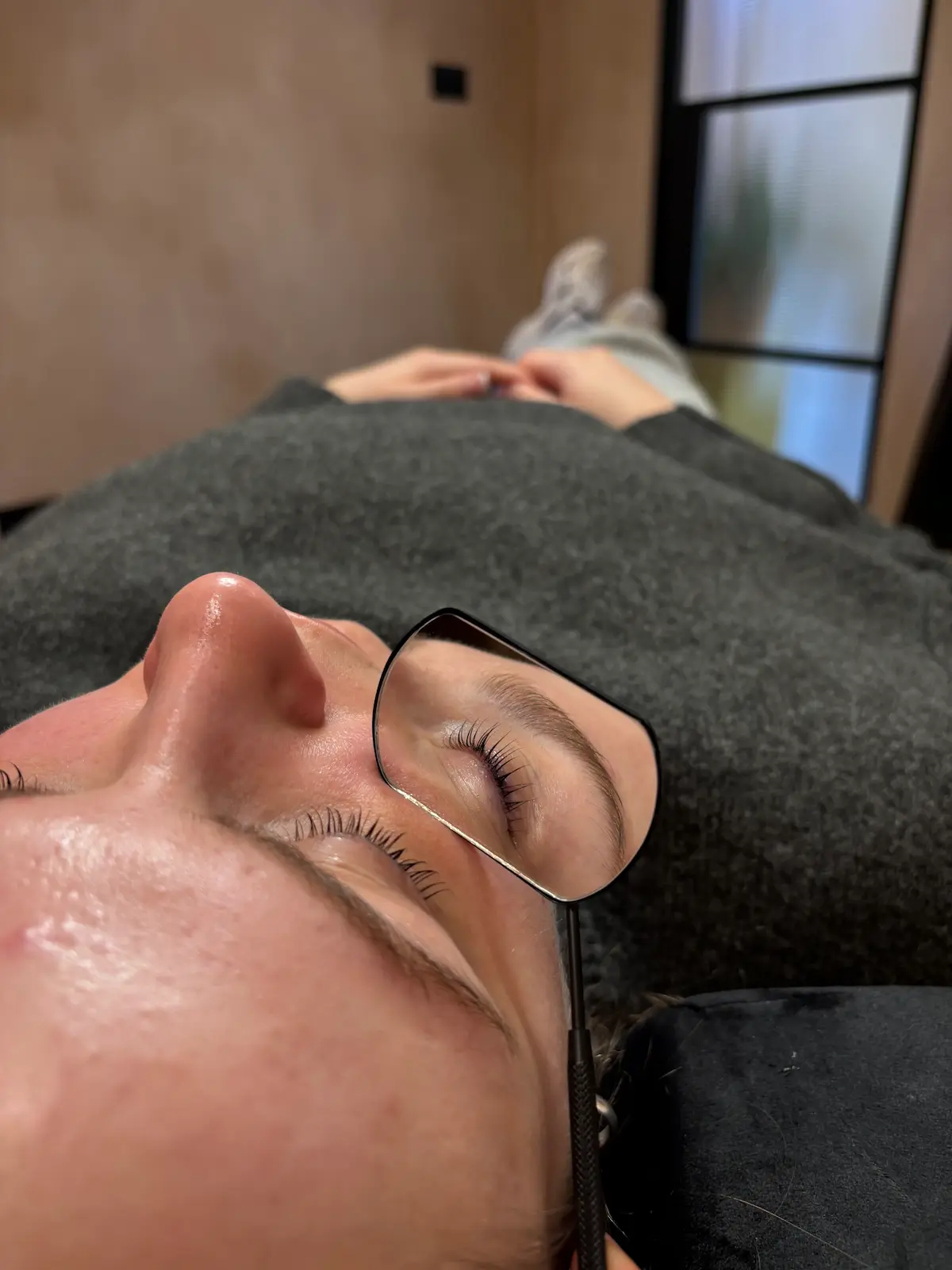 Treatment gallery image 04