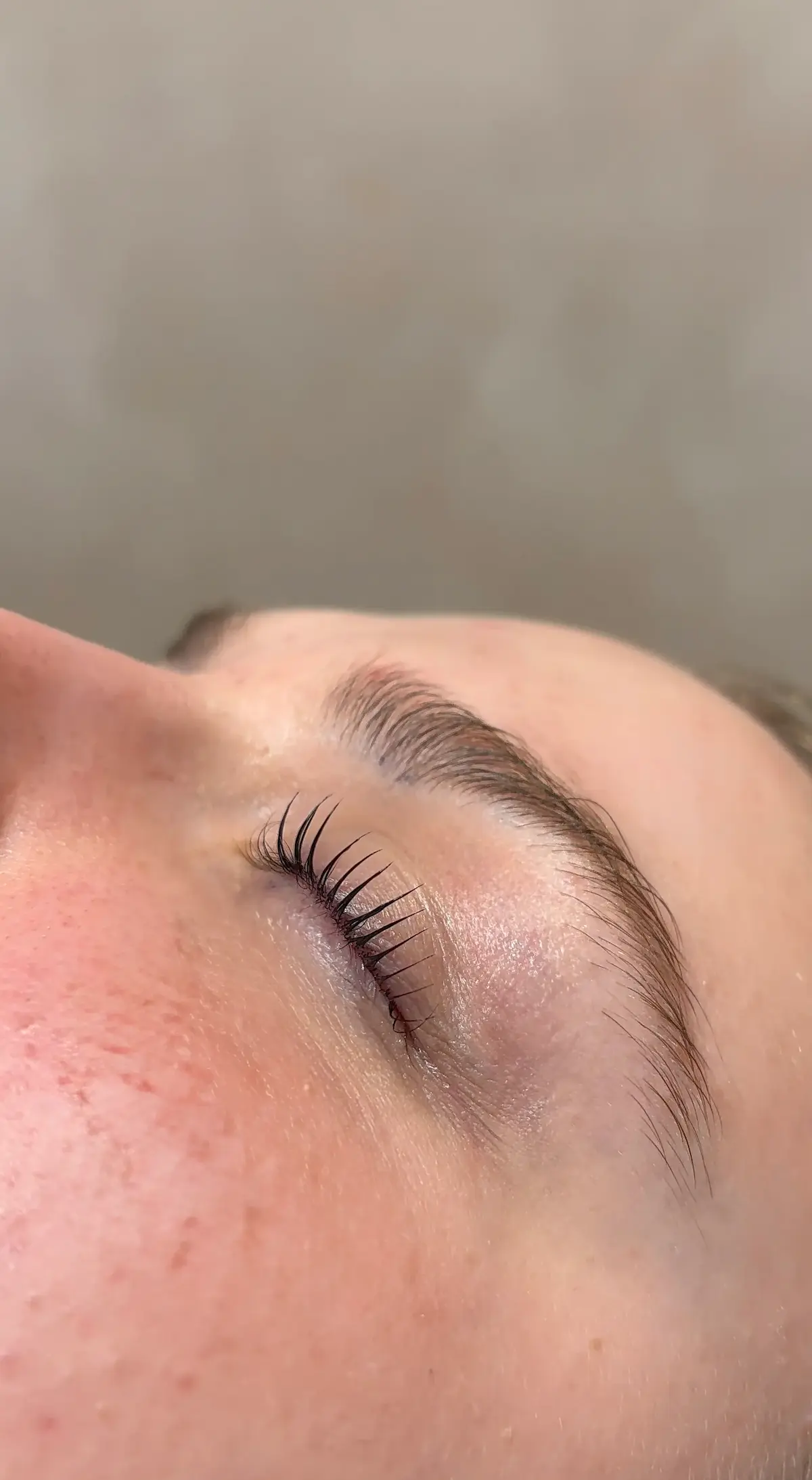 Treatment gallery image 05