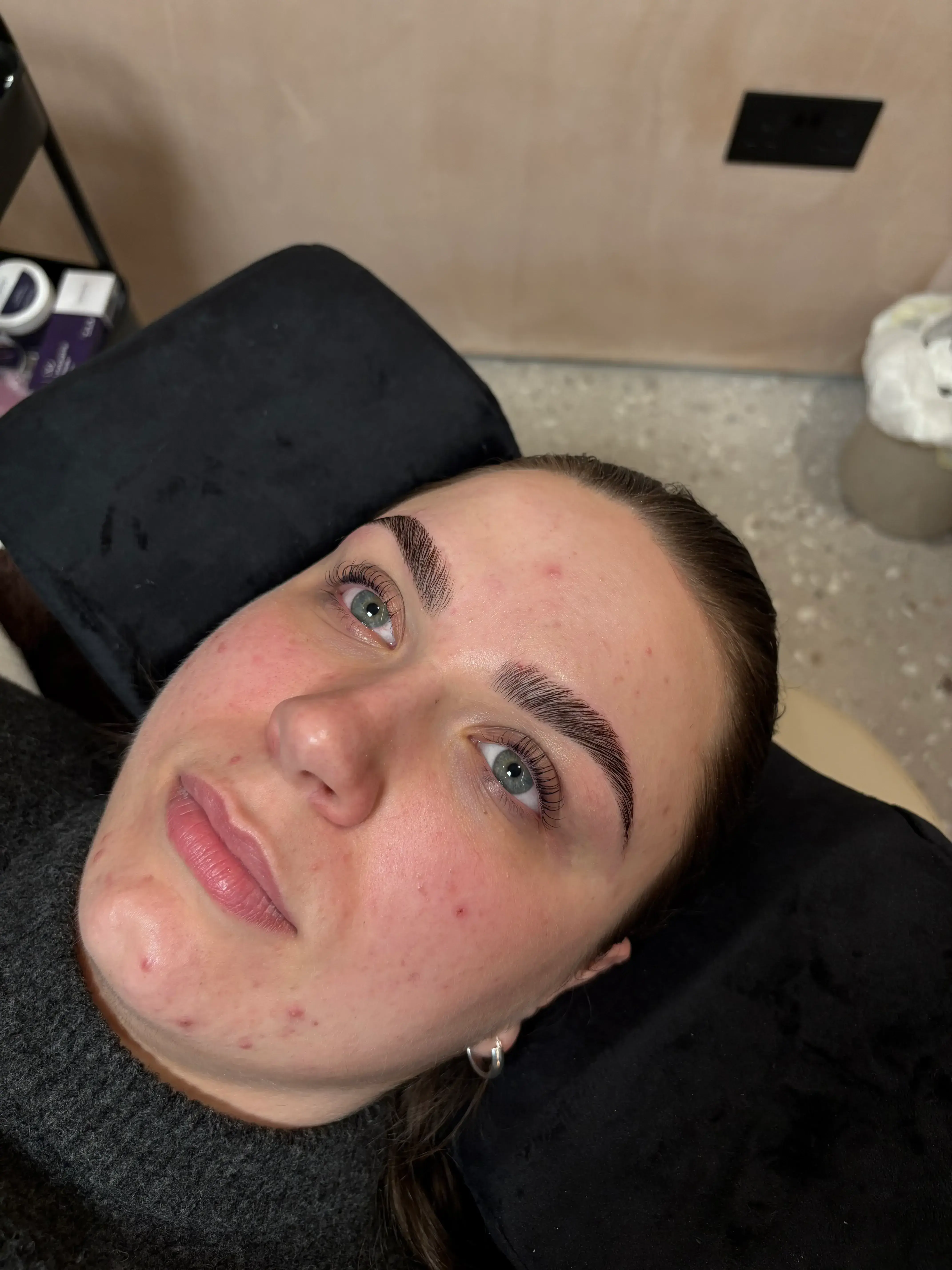 Treatment gallery image 06