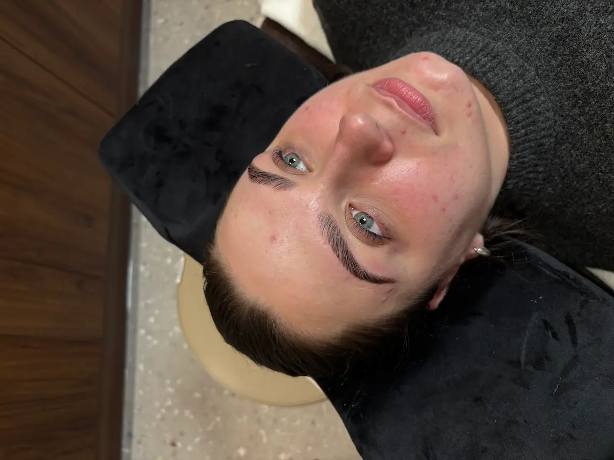 Treatment gallery image 07