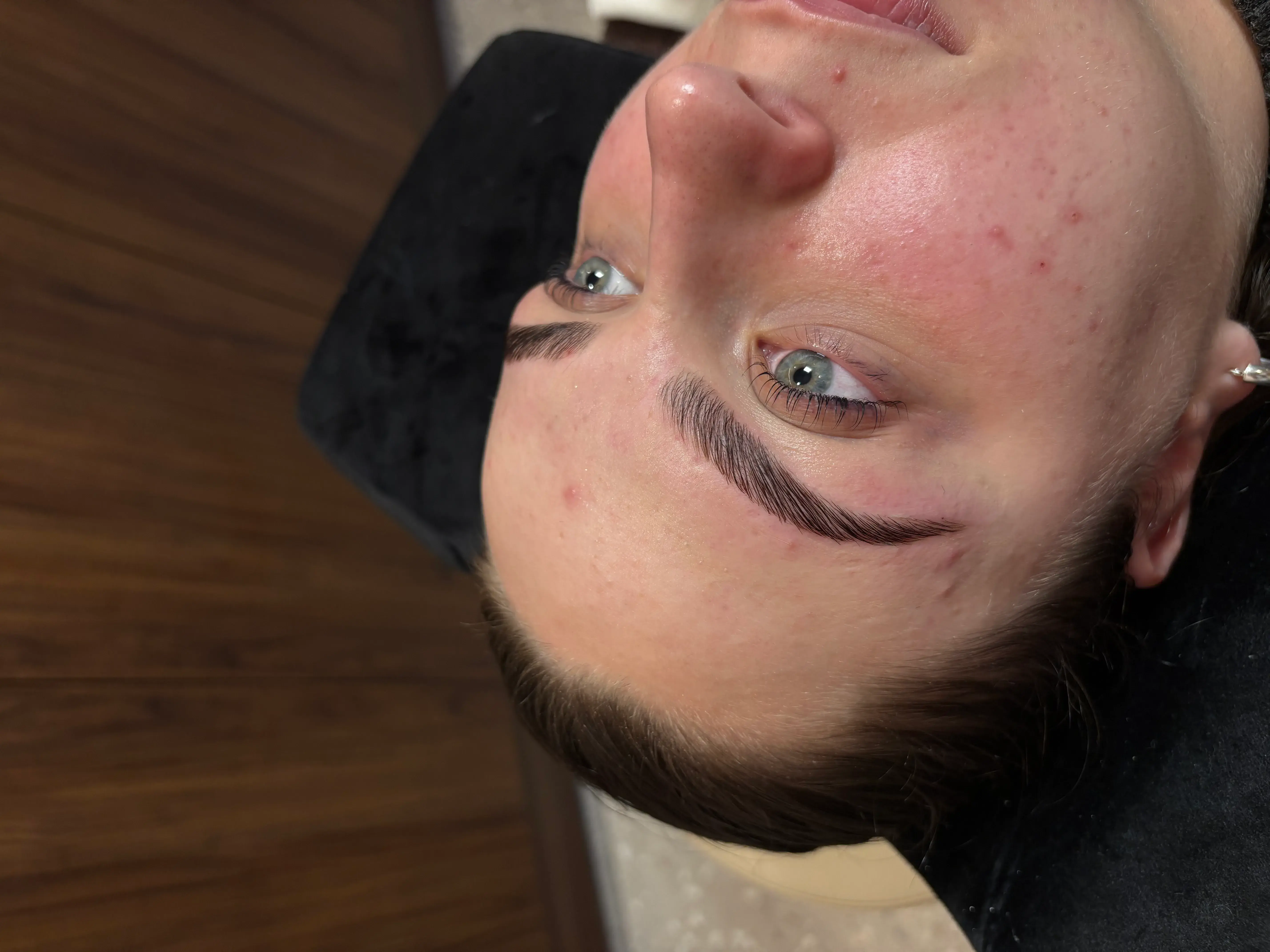 Treatment gallery image 08