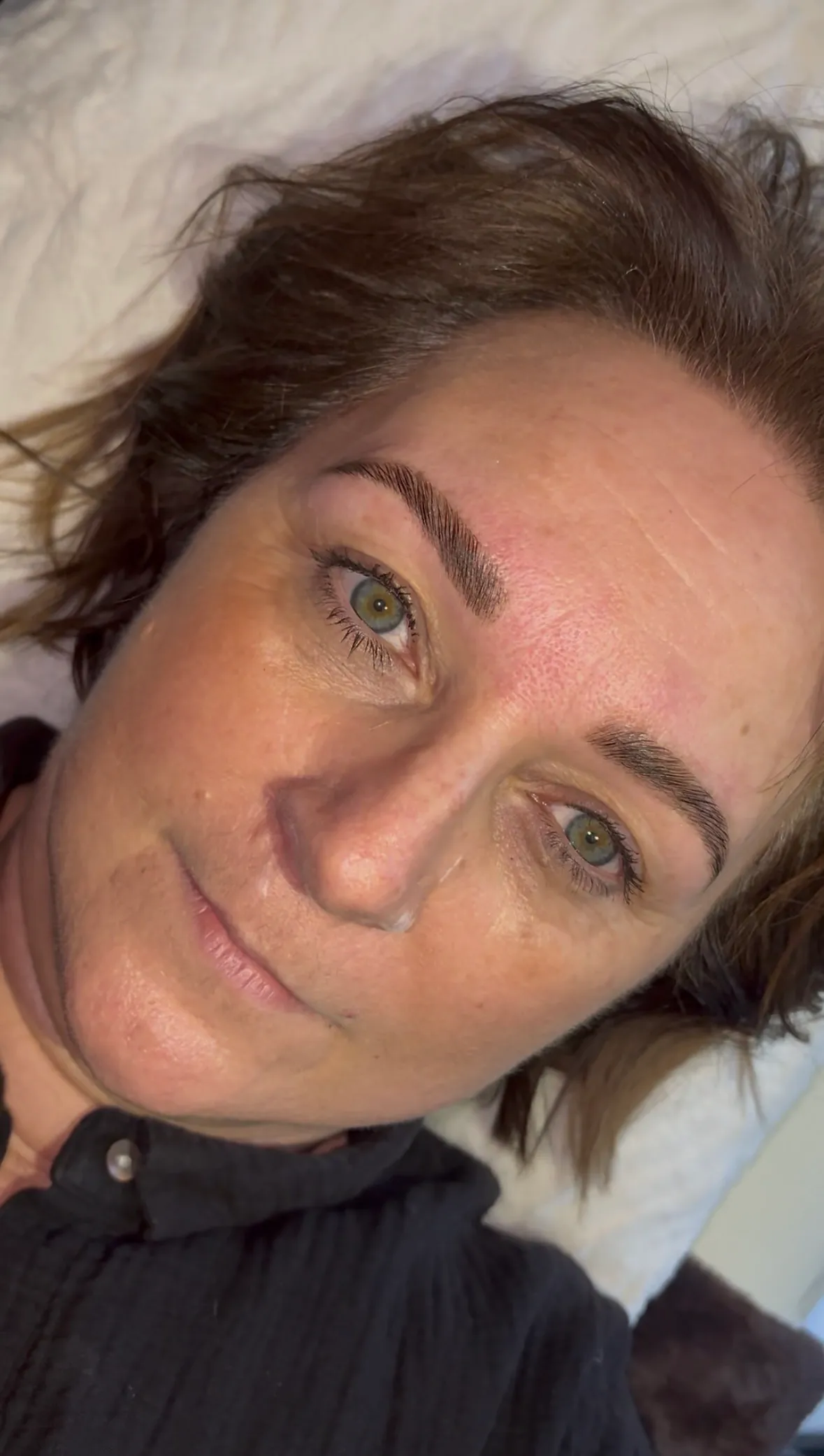 Treatment gallery image 09