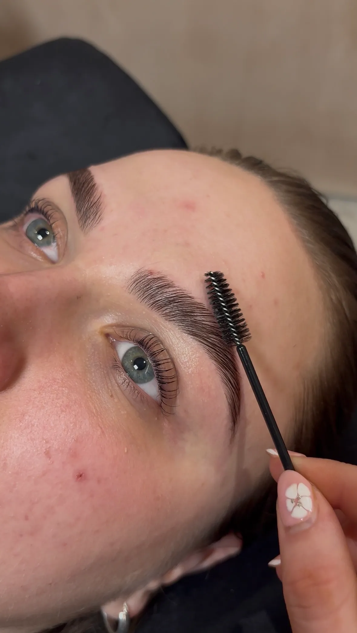 Treatment gallery image 10